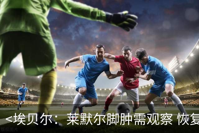 <埃贝尔：莱默尔脚肿需观察 恢复时间未定>